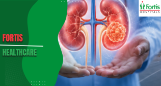 Delhi Best Nephrologist