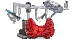 Am I Eligible for Robotic Thyroidectomy