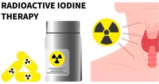 Why Dose Matters in I-131 Therapy