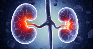 Signs Your Kidneys Are Failing 
