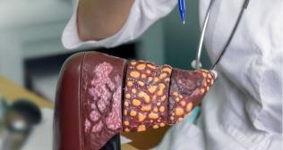 What Does Inoperable Liver Cancer Really Mean?