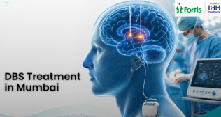 DBS Treatment for Parkinsons in Mumbai