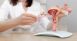 Hysterectomy in Chennai - Cost and Procedures