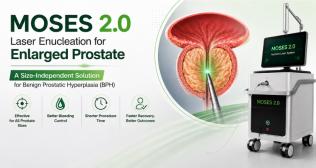 MOSES 2.0 Laser Enucleation for Enlarged Prostate — A Size-Independent Solution for Benign Prostatic Hyperplasia (BPH)
