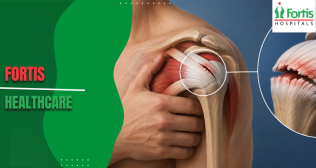 Rotator Cuff Tear on MRI