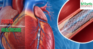 nterventional Cardiology Procedures