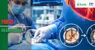 Valve Replacement in India