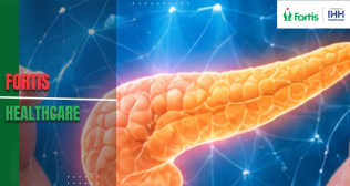 Pancreas Transplant