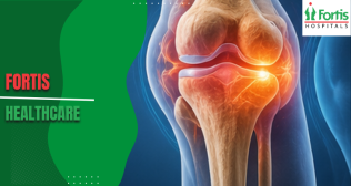 Osteoarthritis