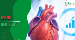 Cardiac Transplant Surgeries