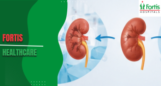 Living Donor Transplant