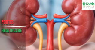 Kidney Transplants 