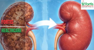 Kidney Disease