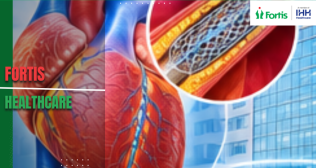 Best Cardiology Hospital in India