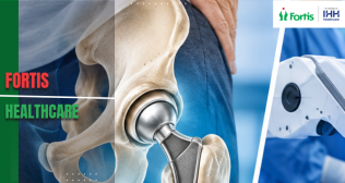 Hip Replacement Cost in Delhi 