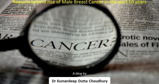 Reasons Behind Rise of Male Breast Cancer In The Past 10 Years