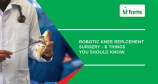Robotic Knee Replcement Surgery - 6 Things You Should Know.