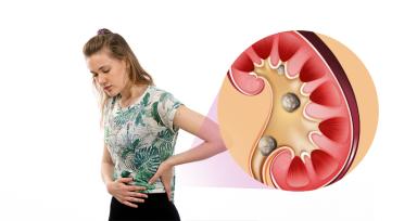 Kidney Stone and Urinary Tract Infection