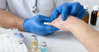 skin allergy