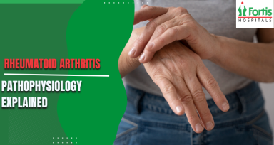 Rheumatoid Arthritis