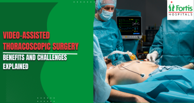 VAT Surgery Benefits
