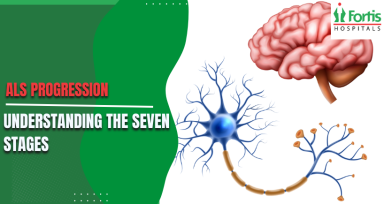 Seven Stages of ALS Progression 