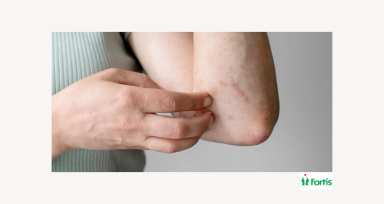 जली वाली त्वचा (Itchy Skin) 