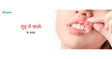मुँह के छाले: कारण