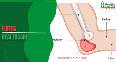 Can Ewing Sarcoma Spread