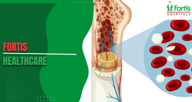Ewing Sarcoma vs Other Bone Cancers
