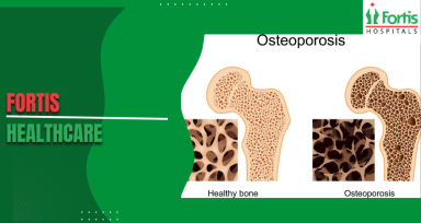 Osteosarcoma Chemotherapy