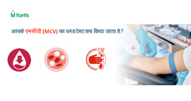MCV Test