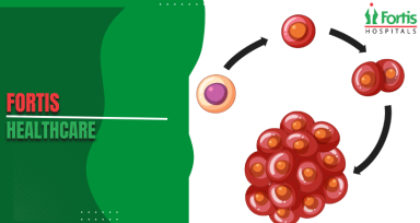 Neuroblastoma Chemotherapy