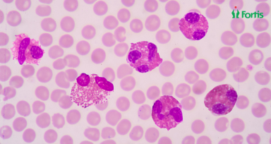 High Eosinophils
