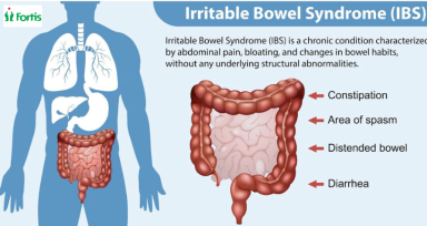 IBS क्या है?