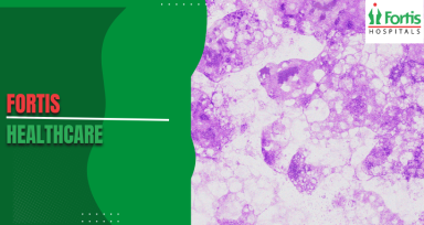 Pleomorphic Rhabdomyosarcoma