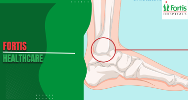 Osteosarcoma