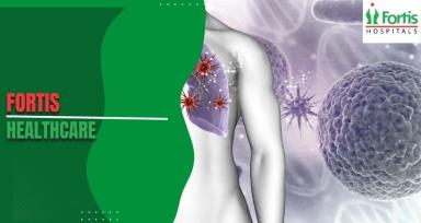 Choriocarcinoma Explained