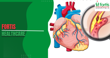 Arteriovenous Malformation Symptoms