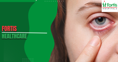 Blepharitis Causes