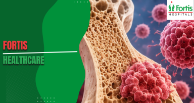 Osteosarcoma Causes