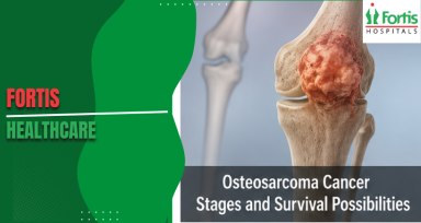 Osteosarcoma Cancer