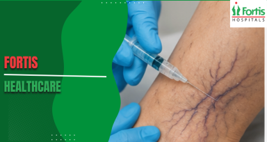 Treating Venous Malformations in Children