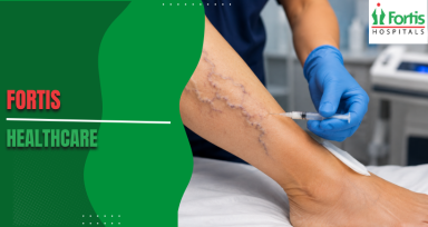 Foam Sclerotherapy 