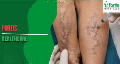  Sclerotherapy 