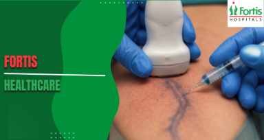 Modern Advances in Sclerotherapy