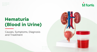 Best Hematuria (Blood in Urine) treatment in Navi Mumbai