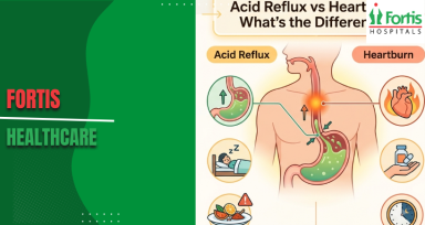 Acid Reflux vs Heartburn