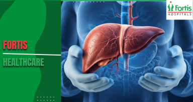 Liver Transplant in Delhi 