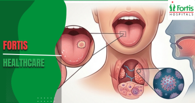 Oral Cancer